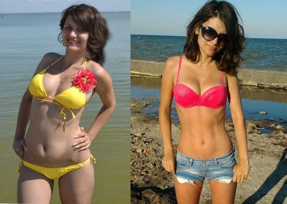Anna a slăbit 10 kg cu NexaSlim